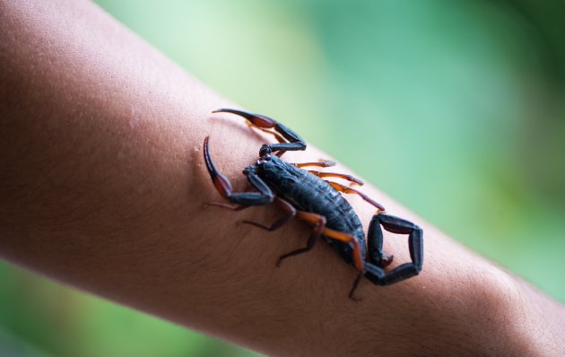 Diagnóstico y Tratamiento de Picaduras y Mordeduras de Animales Ponzoñosos